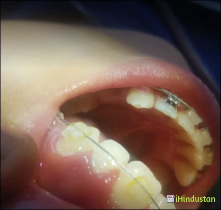 Dr Gaurav Chaudhary Best Dentist - Logo