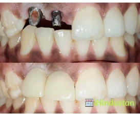 Dr. Gowds Dental Hospitals - Logo
