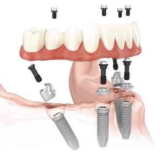 Dr Gowds Dental Hospital - Cover photo