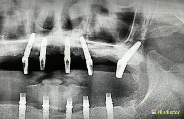 Dr Gyan Prakash MDS -Prem dental care - Logo