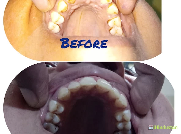 Dr. Himanshu Kushwaha Dental Care Clinic - Logo