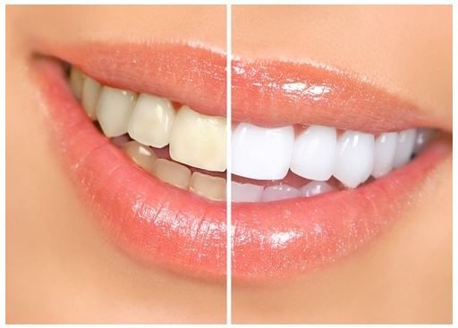 Dr. Johl Melbourne Family Cosemetic and Dentistry - Cover photo