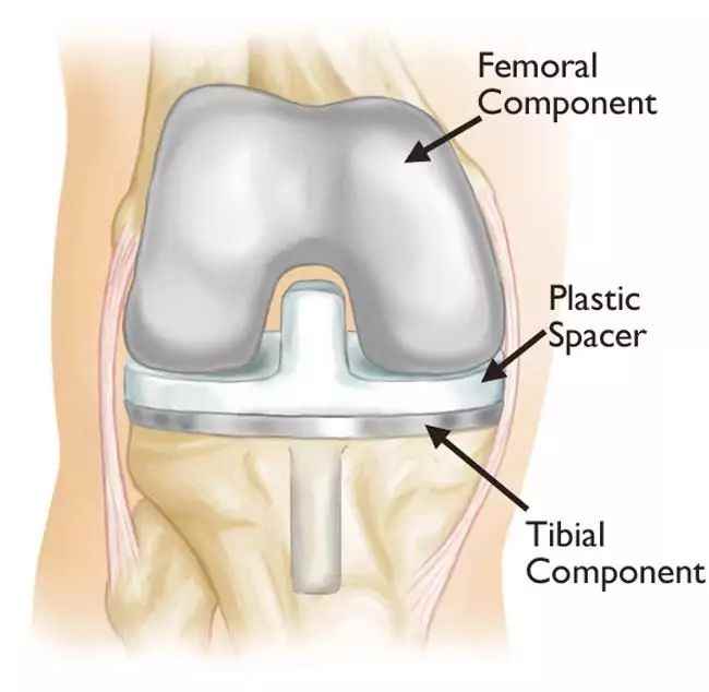 Dr Kaushal Kant Mishra Orthopaedic Surgeon - Cover photo