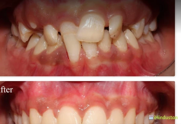Dr. Lipare's Advanced Dental Clinic - Logo