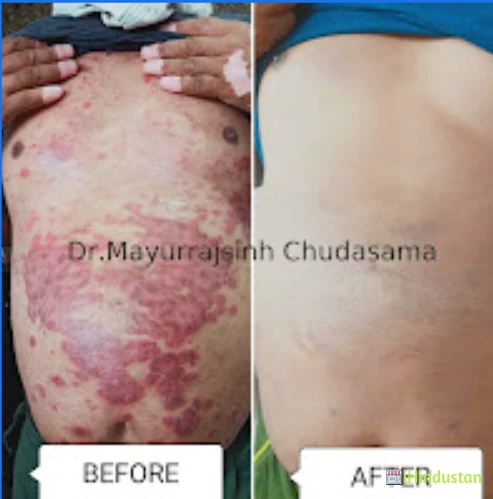 DR. MAYURRAJSINH CHUDASAMA'S OM HOMOEOPATHY CLINIC - Logo