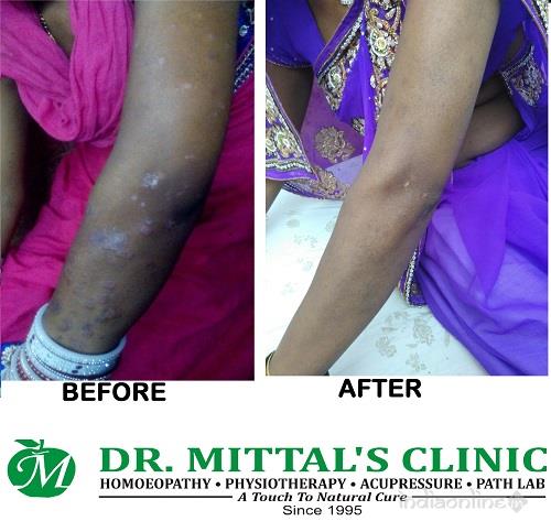 Dr Mittals Clinic - Cover photo