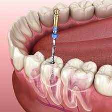 Dr Phukans Dental Braces And Orthodontic Clinic - Cover photo