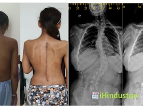 Dr Pramod Saini Spine Surgeon - Logo