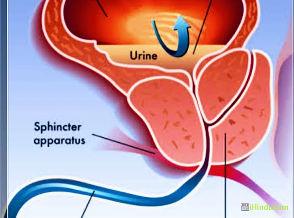 Dr Sadagopan M - Urologist # Kidney Stone - Logo