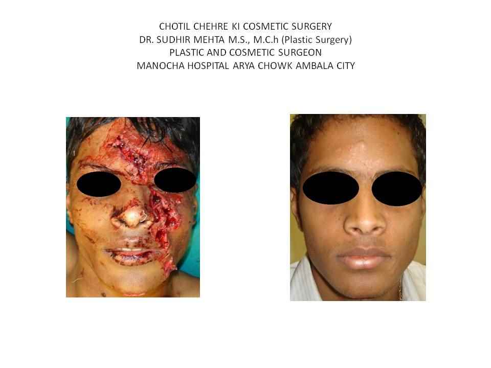 Dr Sudhir Mehta Plastic Surgeon - Cover photo