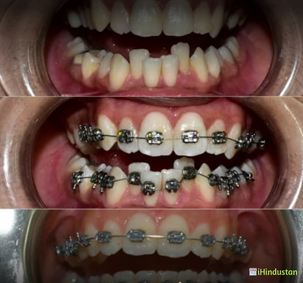Dr.Teeth Dental Care - Logo