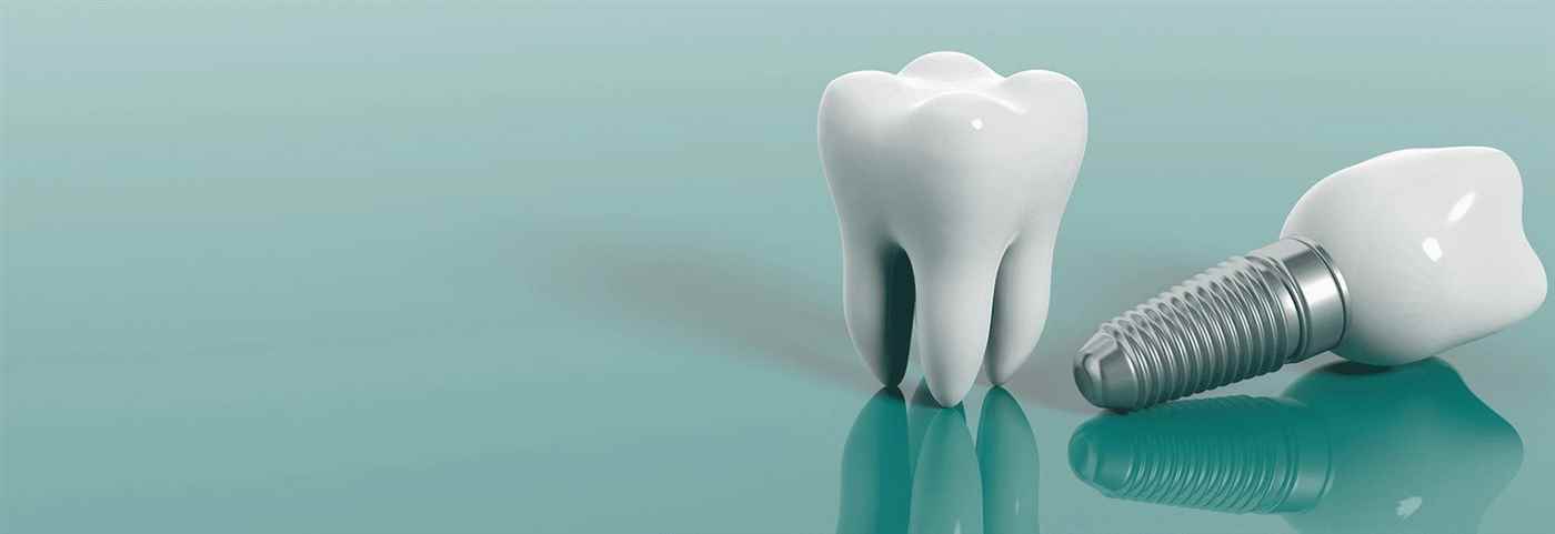 Dr Vishal Jain Dentist In Alwar - Cover photo