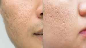 Dr Yashwant Lal Dermatologist - Cover photo