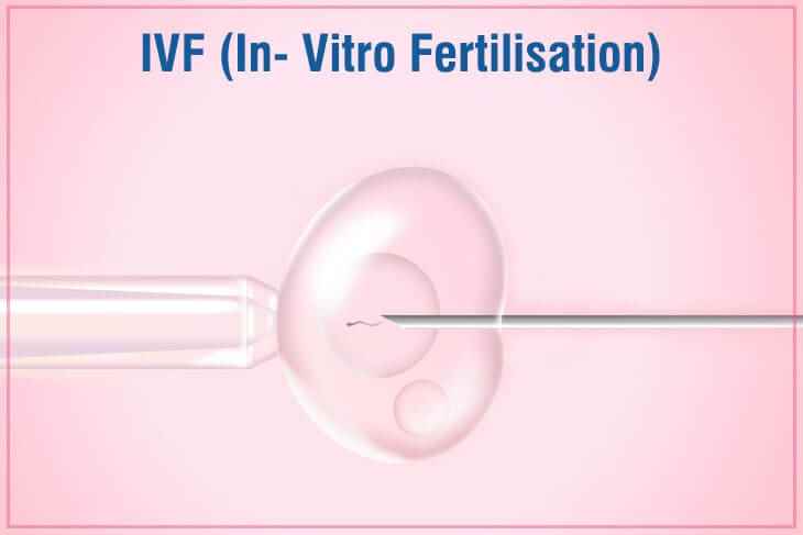 Eeshan Ivf - Cover photo