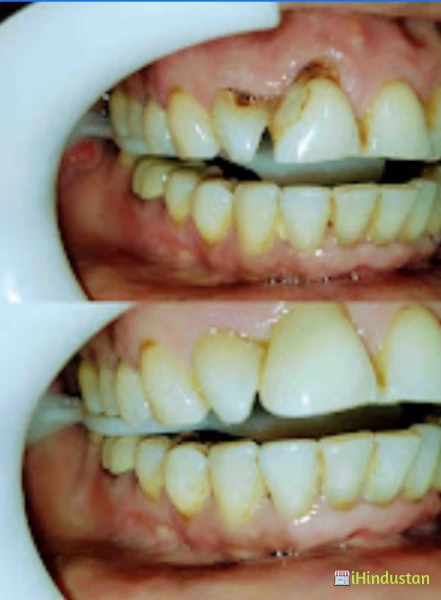Elite Dental Clinic - Logo
