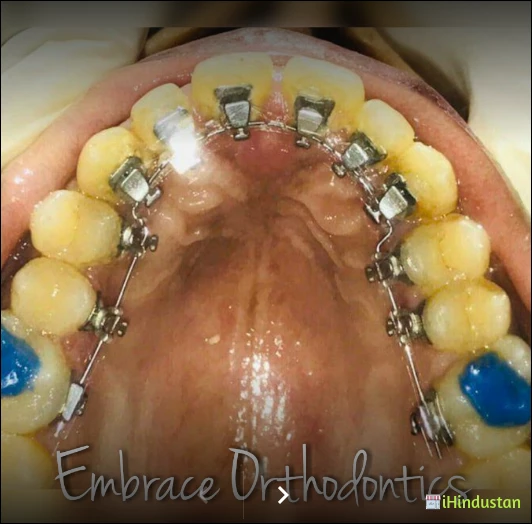 Embrace Orthodontics - Logo