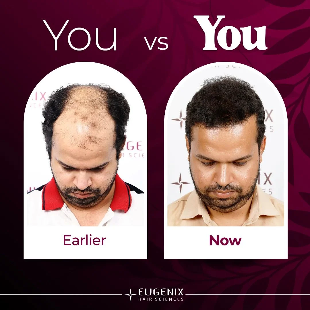 Eugenix Hair Sciences - Cover photo