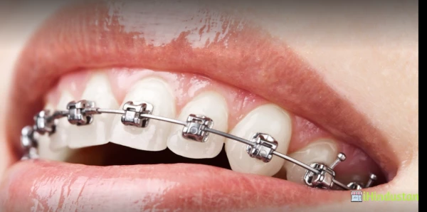 Exclusive Orthodontic Clinic - Logo