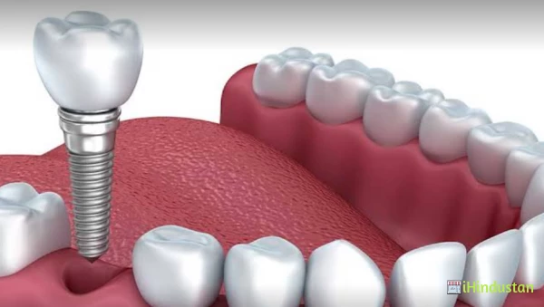 Expedent Dental Clinic - Logo