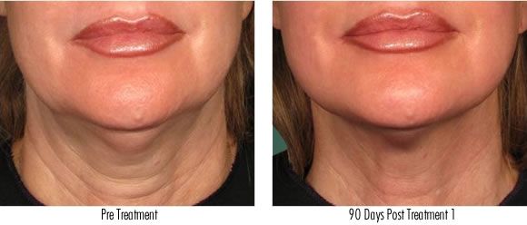 FAB Laser And Skin Care - Cover photo