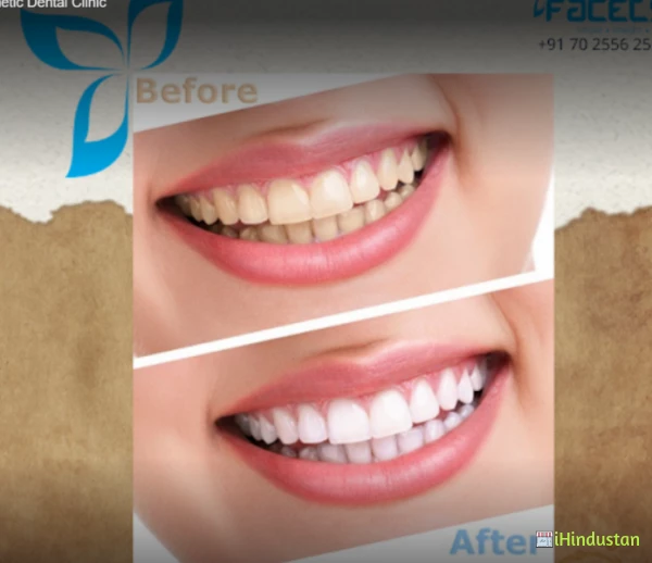 Facets - Cosmetic Dental Clinic - Logo