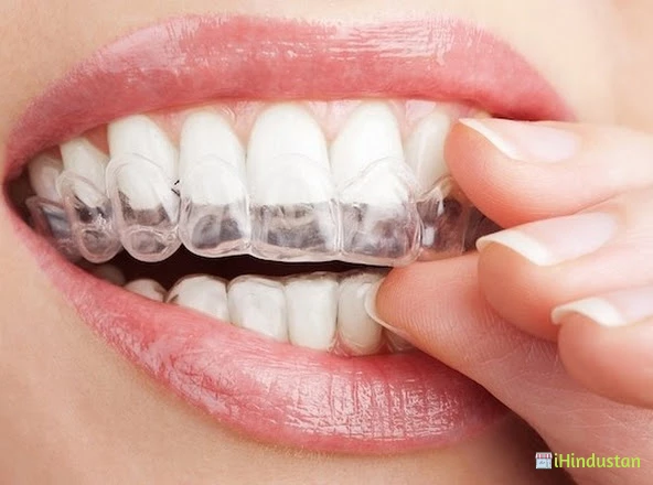Facets Dental Aligner Clinic - Logo