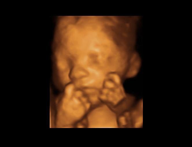 Firstlook 3D &a; 4D Ultrasounds - Logo
