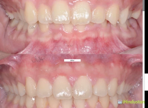 Fresh Smile Multispeciality Dental Clinic - Logo
