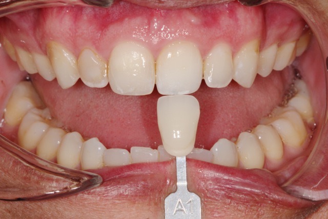 Fusion Dental Care - Logo