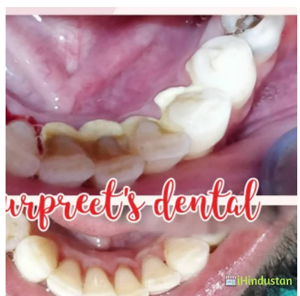 Gurpreet' s Dental clinic - Cover photo