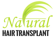 Hair Transplant in Allahabad - Logo