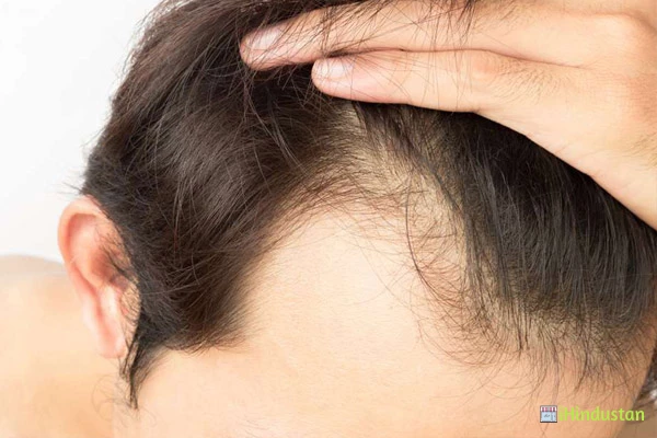 Hair Transplant Hyderabad - Logo