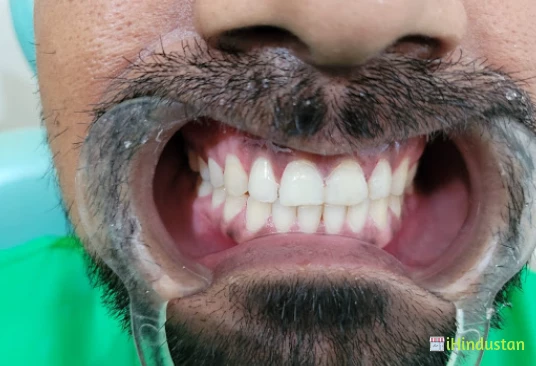 Happy Smiles Multispeciality Dental Clinic - Logo