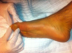 Honey&s;s Foot Care - Logo