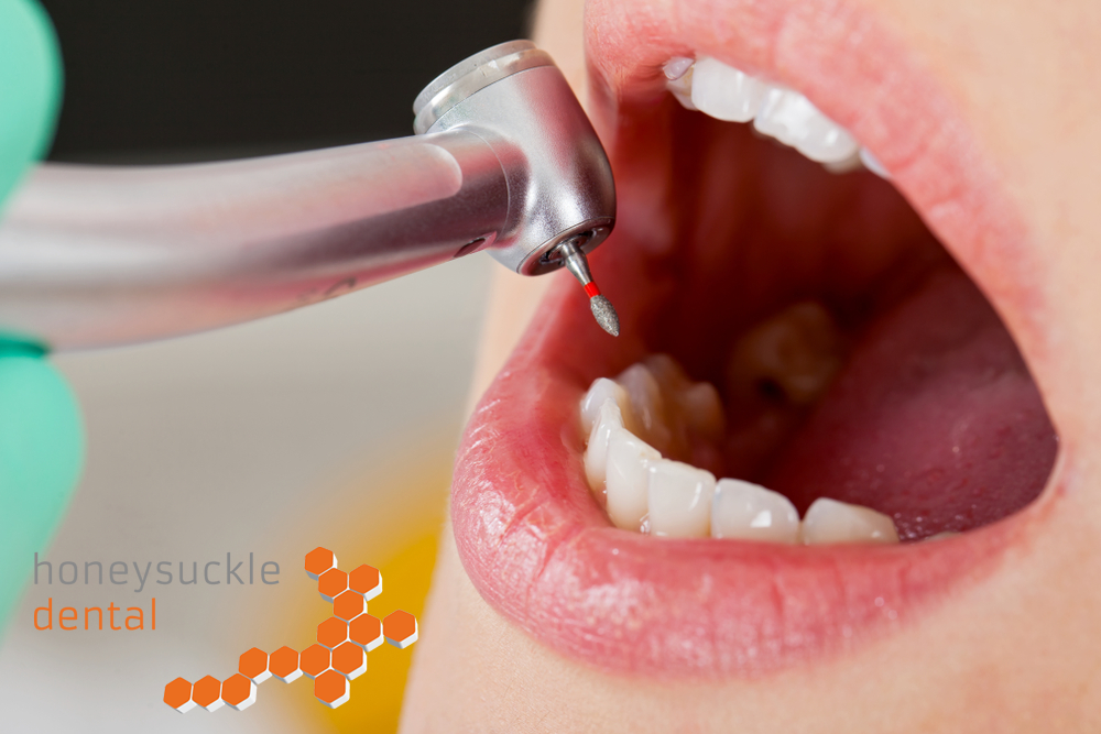 Honeysuckle Dental - Cover photo