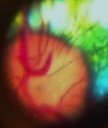 I C You Mobile Optometry - Logo