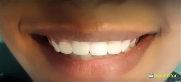Indira Dental Clinic - Logo