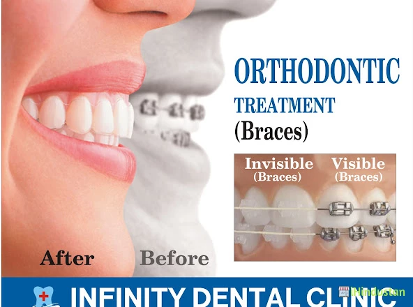 Infinity Dental Clinic - Logo