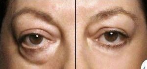 Instantly Ageless Distributer Vernon - Cover photo