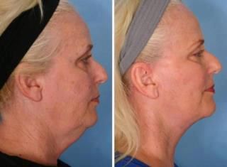It Works Independent Distributor - Joey Petilkau - Cover photo