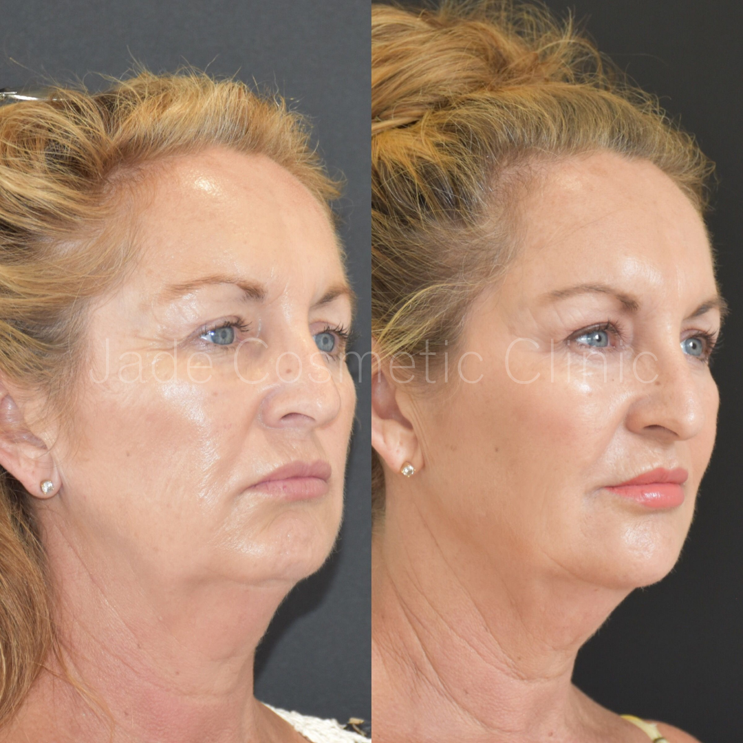 Jade Cosmetic and Wellness Clinic - Cover photo