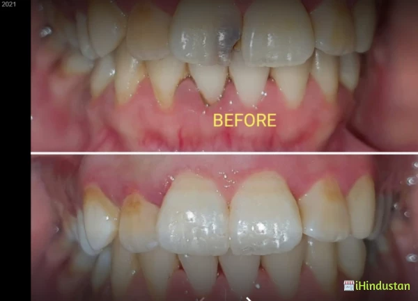 JJEDC Jodhpur Endodontic & Dental Implant Centre - Logo