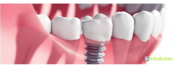 Kalsi Dental Clinic - Logo