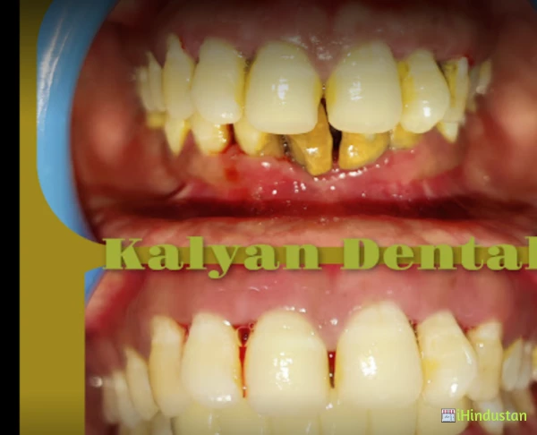 Kalyan Dental - Logo