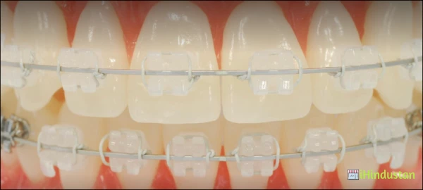 Kansal Dental Clinic and Orthodontic Center - Logo