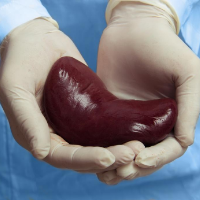 Kidneytransplanthospital - Cover photo