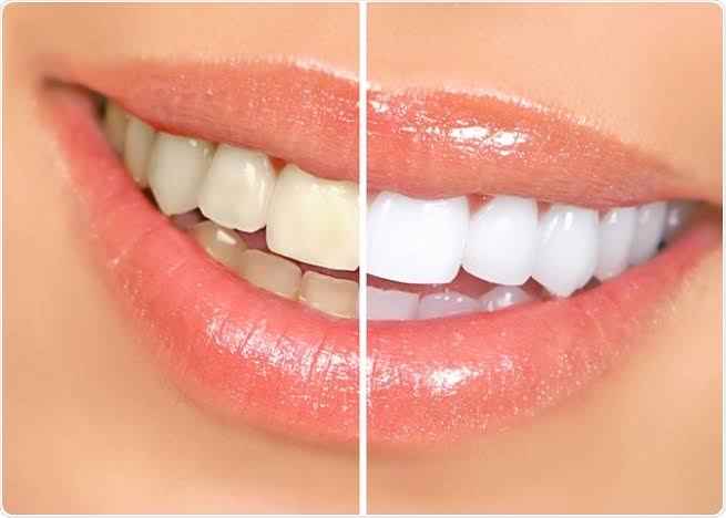 Kiran Dental Clinic - Cover photo