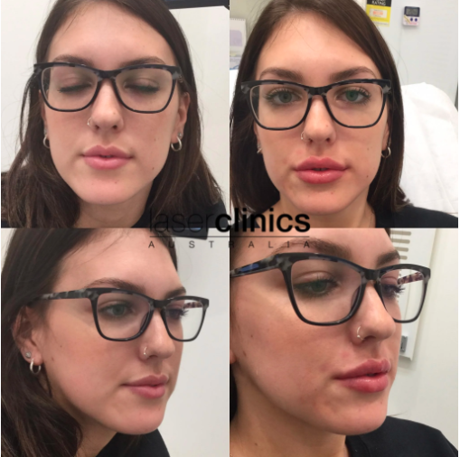 Laser Clinics Australia Belconnen - Logo