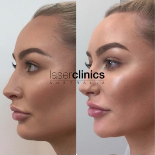 Laser Clinics Australia Woden Westfield - Cover photo