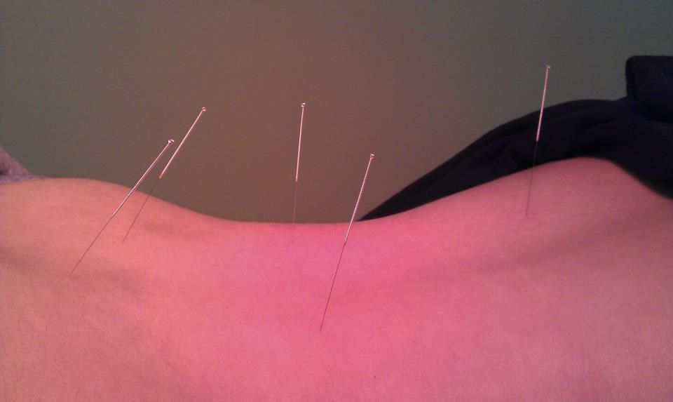 Lisa Chen, Acupuncturist - Cover photo
